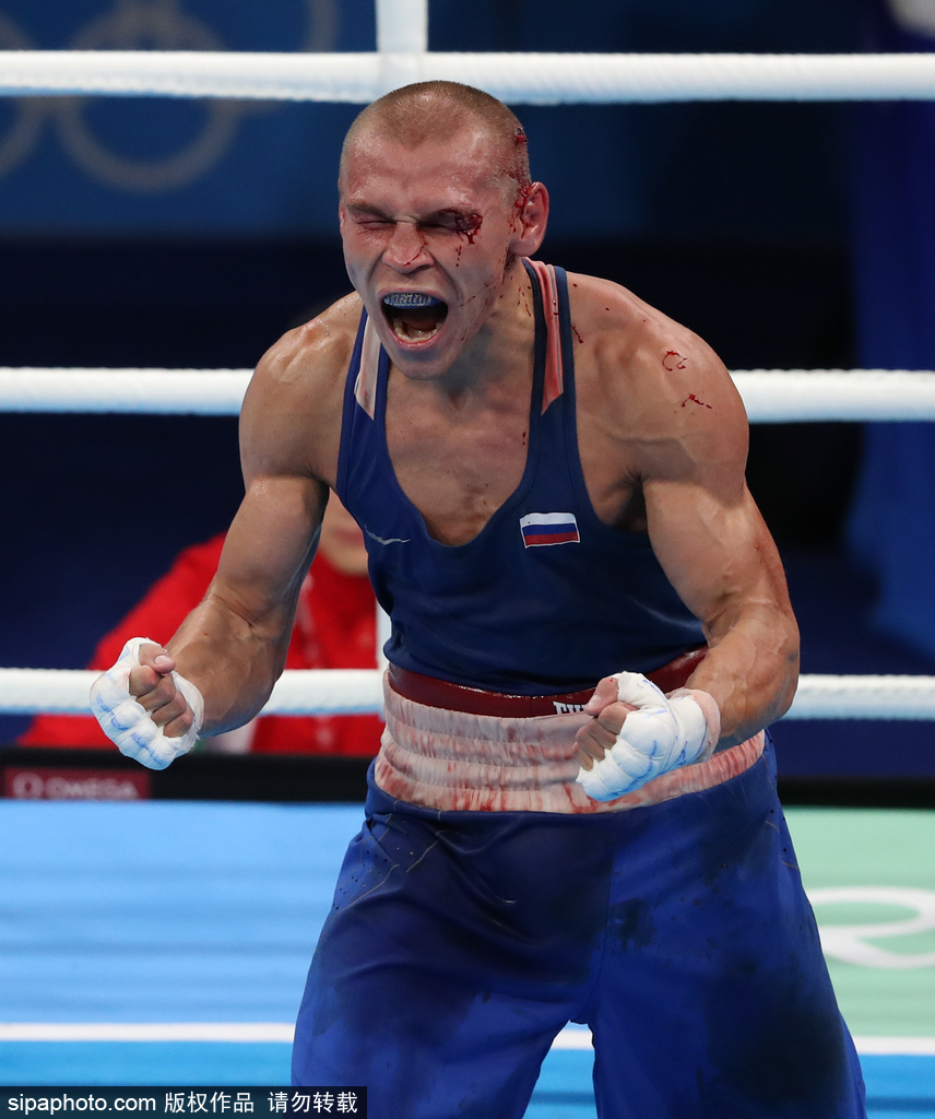 勝負(fù)無關(guān) 氣勢更重要！盤點(diǎn)奧運(yùn)會賽場的“怒吼天尊”