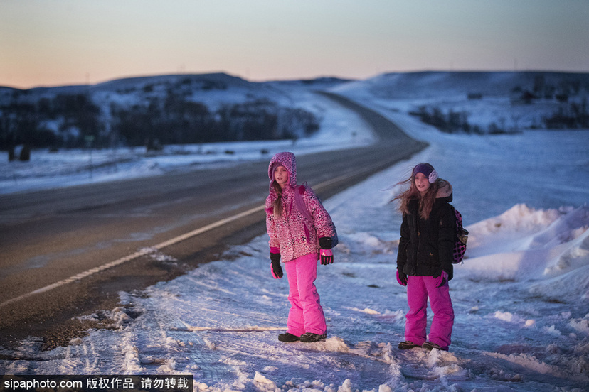 美國孿生連體姐妹分離手術后已茁壯成長11年