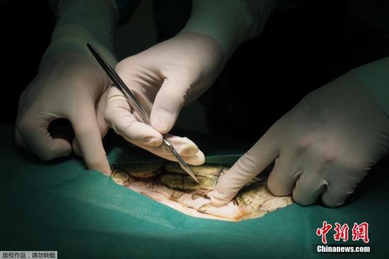 海龜誤食許愿池硬幣 醫生為其手術取出915枚(圖)