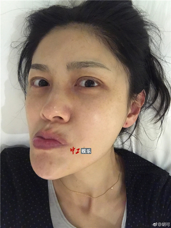 胡可曬素顏斗圖放飛自我 網友：沙溢快來出大事啦！