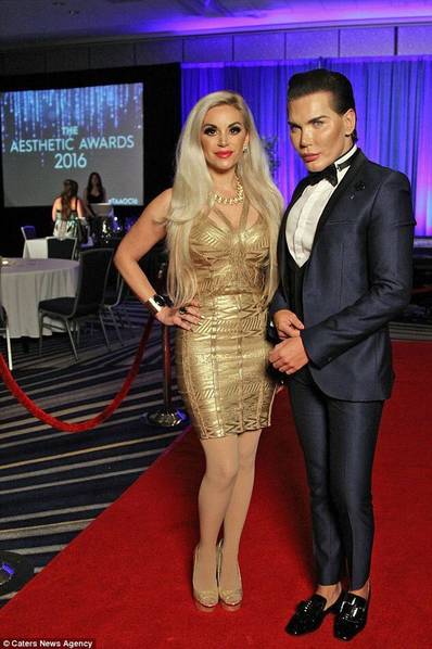 男子花300萬整容51次 破吉尼斯紀錄