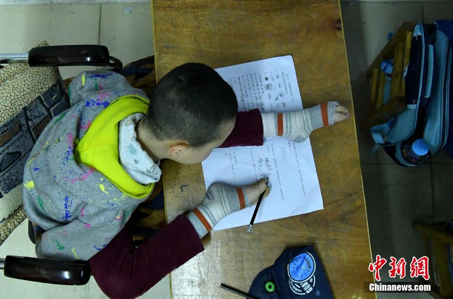 無臂男孩的快樂生活