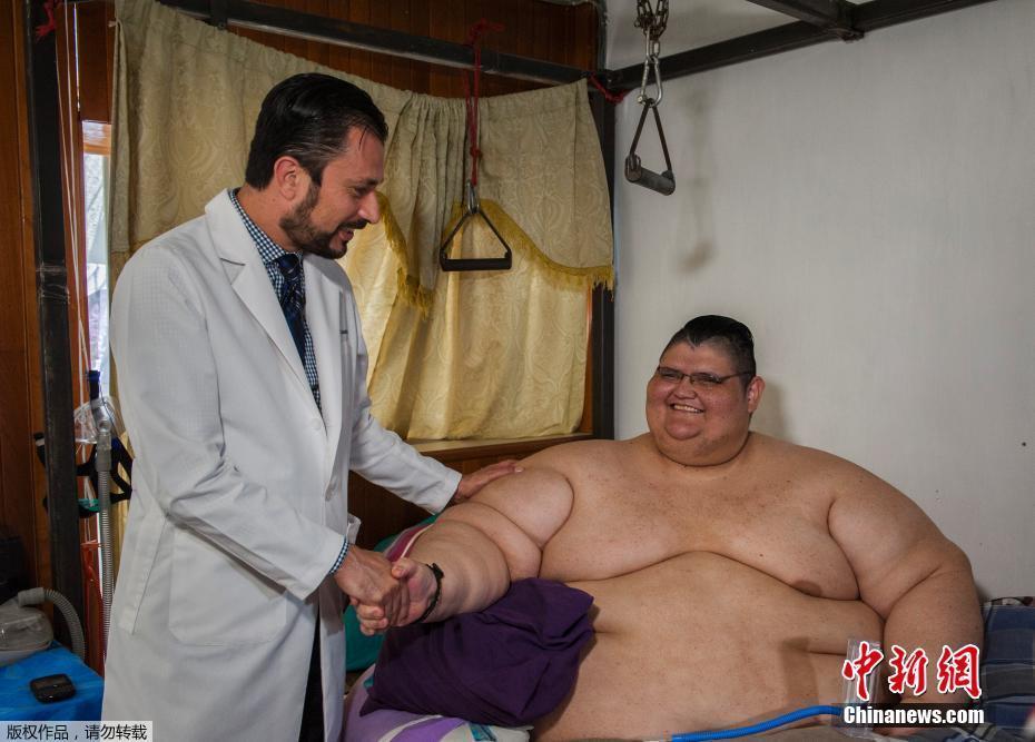 墨西哥男子體重曾達(dá)半噸 網(wǎng)友：有點(diǎn)像米其林(圖)