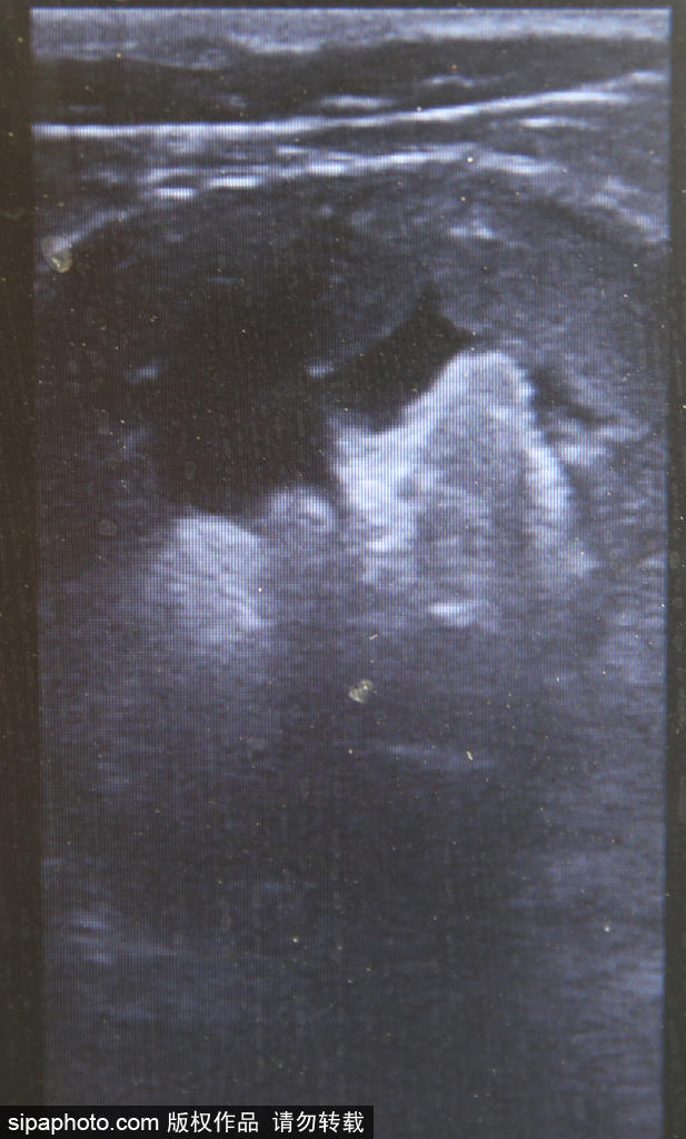 樹懶也有牙病？德國哈雷動物園樹懶接受牙醫治療